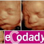 Ecografía 5D de bebé de 27 semanas