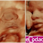 Ecografía 5D de bebé de 36 semanas de Ecodadys