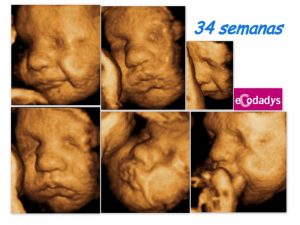 Bebé de 34 semanas poniendo morritos en ecografía