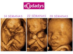 Ecografia de bebé de 14, 22 y 28 semanas