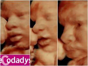 Tres fotos de ecografía de bebé con la boca abierta y cerrada