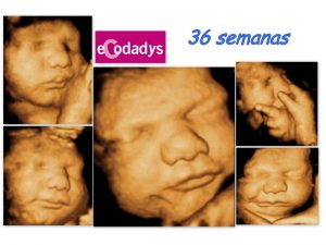 Ecografía de bebé 36 semanas