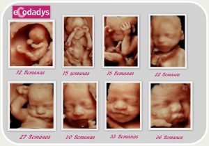 Ecografía de bebé durante distintas semanas del embarazo